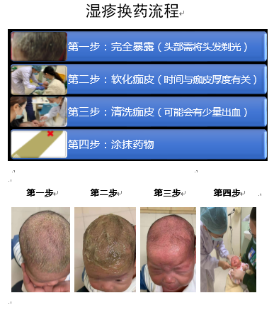 湿疹换药截图.PNG